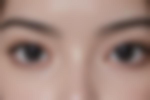 严格的医疗