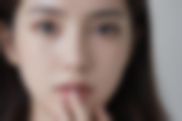 烧伤后如何处理？这份实用指南请收好