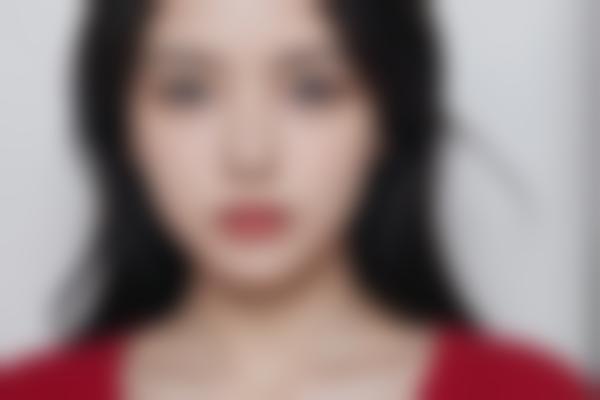 济南高新佳美医疗美容整形诊所怎么样？正规靠谱吗？