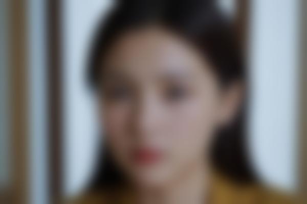 是正规的医美项目吗