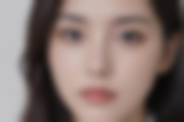 天津怡贝德尚医疗美容门诊部面部整形价格一览 附特色项目解析