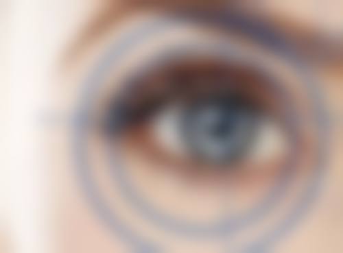 北京艺星医疗美容医院微创重脸术采用了什么产品和技术呢？