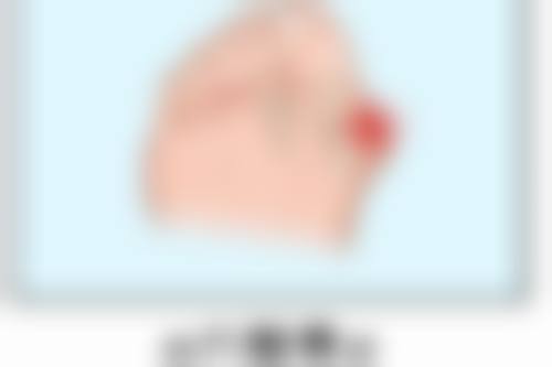 上海蔷薇阳光医疗美容门诊部王曼医生瘦脸轮廓技术怎么样？