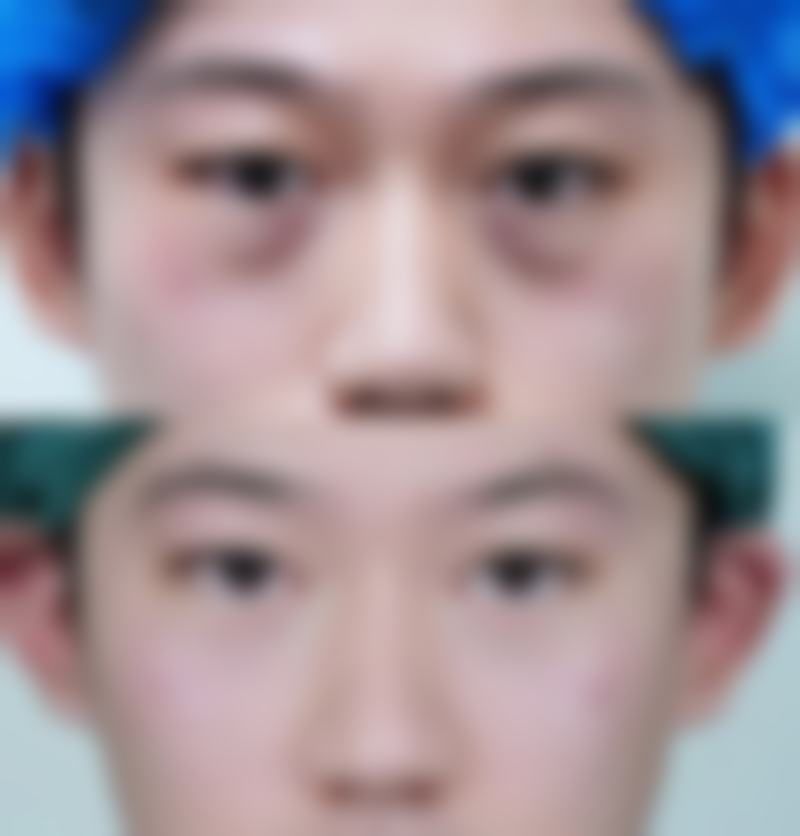 上海蔷薇阳光医疗美容门诊部王曼医生怎么样？