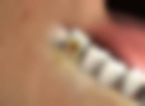 抚州江医生整形医院口碑评价怎么样？