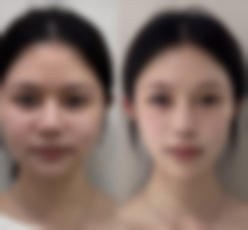 承德铧中整形医院口碑评价怎么样？