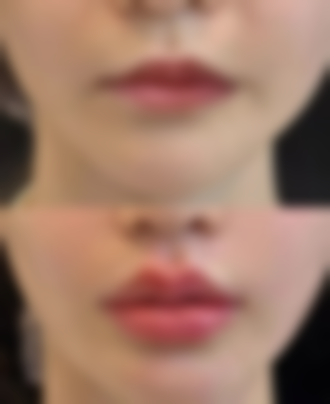 襄阳青果青橙医疗美容诊所收费价格表