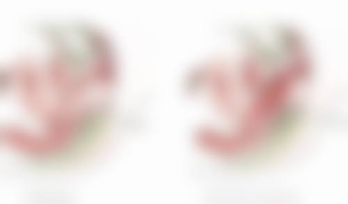 双眼皮改单眼皮有哪些手术方式？