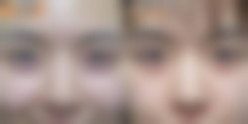 哈尔滨双燕医美常维国医生擅长项目