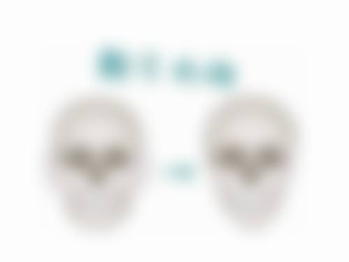 吸脂隆胸手术效果怎么样？真实案例解析与专家见解！效果持久自然且安全性高吗？ 