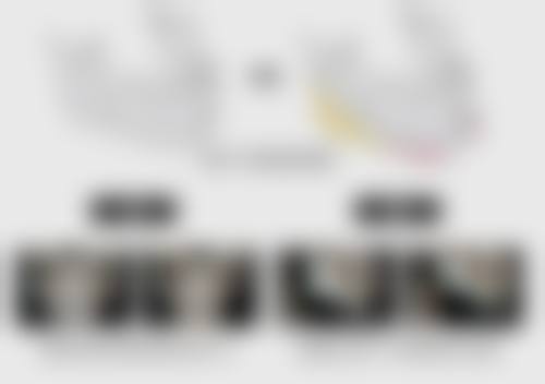 北京圣嘉新医院自体脂肪隆胸对心理和生活质量有什么影响？