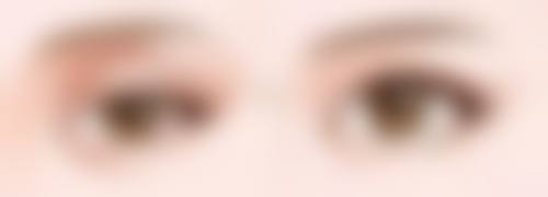 问题三：萎缩性疤痕（凹陷性痘坑、萎缩纹）的去除办法有哪些？