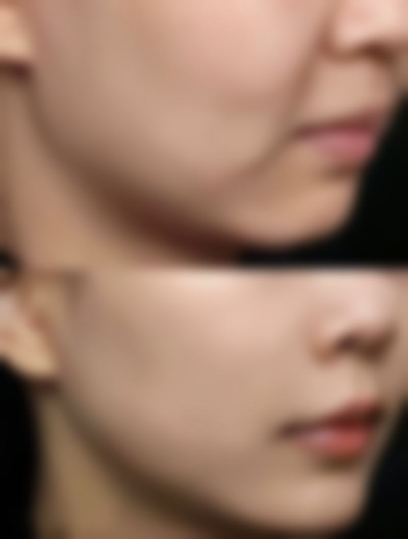 手术前需要做哪些准备呢？