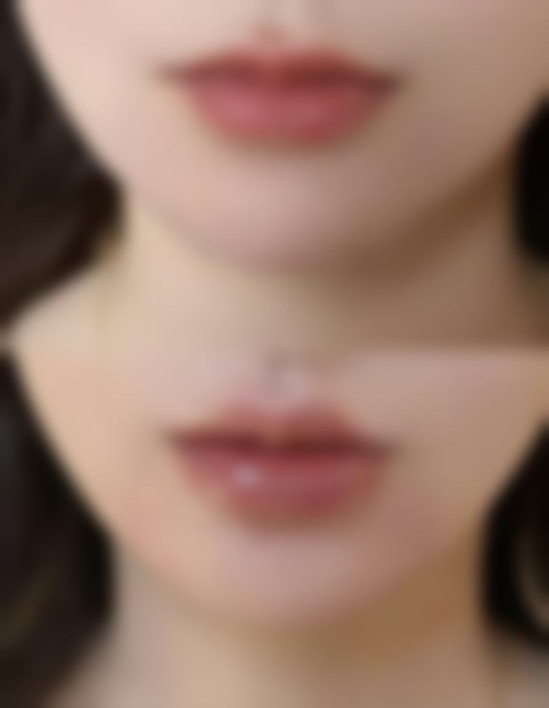 北京圣嘉新医院自体脂肪隆胸后脂肪吸收情况如何？