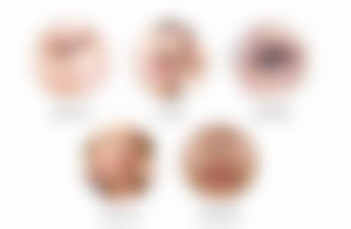 祛眼袋手术后会复发吗？揭秘术后护理与复发风险的真相！如何降低复发几率你了解吗？ 