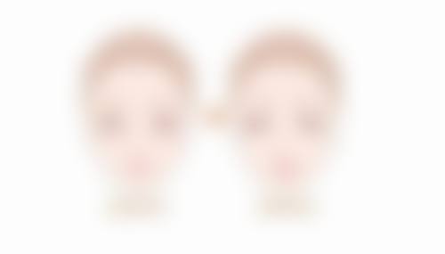 手术祛除眼袋有哪些优缺点呢？