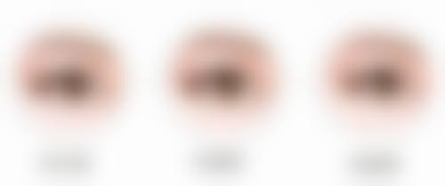 压力治疗与硅胶产品对增生的疤痕疙瘩有什么作用？