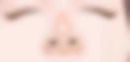 双眼皮眼角发白是什么原因？揭示背后的健康信号与解决方法！是贫血、炎症还是其他因素？ 