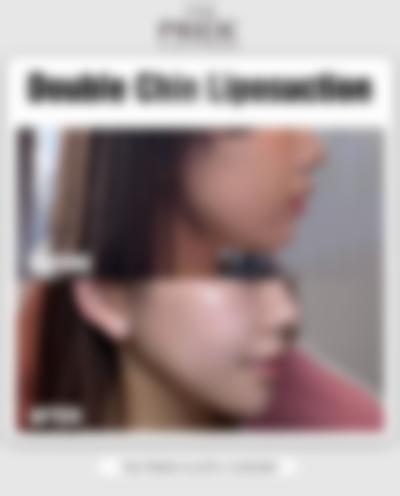 武汉忆美凯德整形医院口碑评价怎么样？