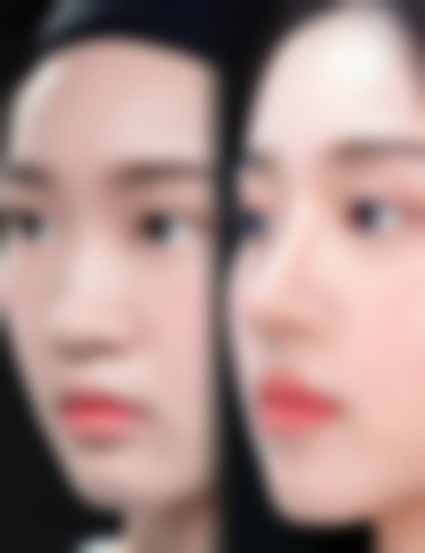 有哪些其他疾病因素会引起双眼皮眼角发白呢？