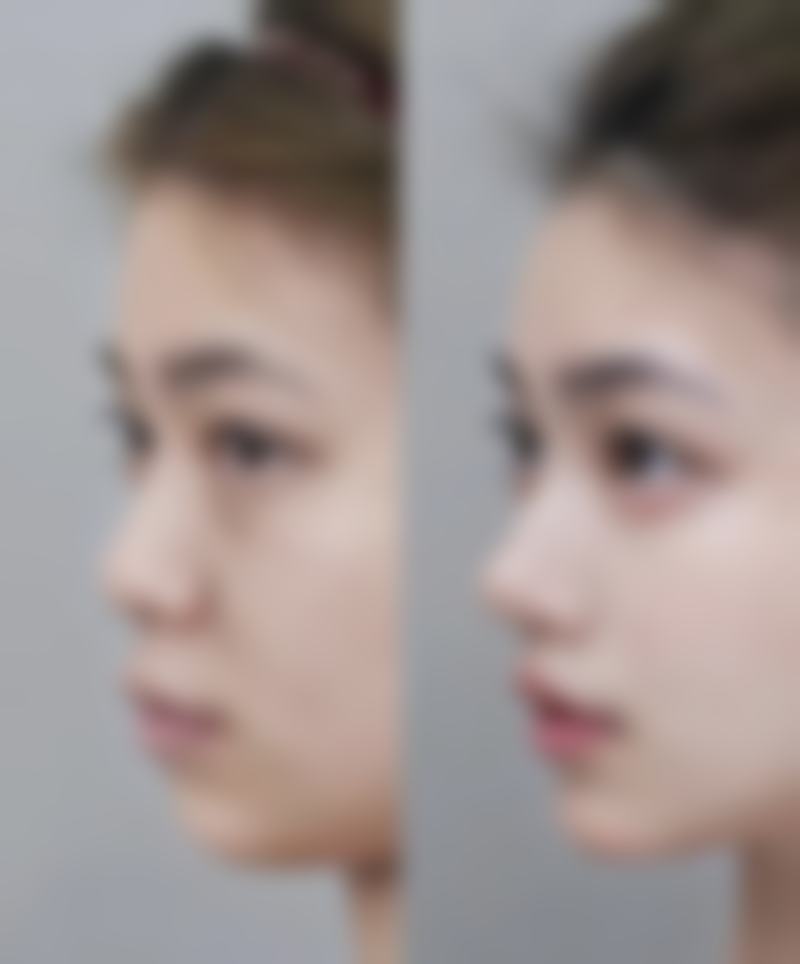 威海可人整形美容机构口碑评价怎么样？