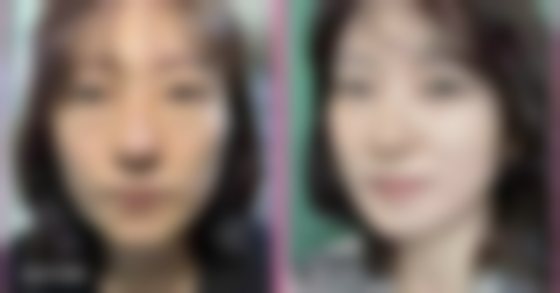 复方肝素钠尿囊素凝胶适用于什么情况？