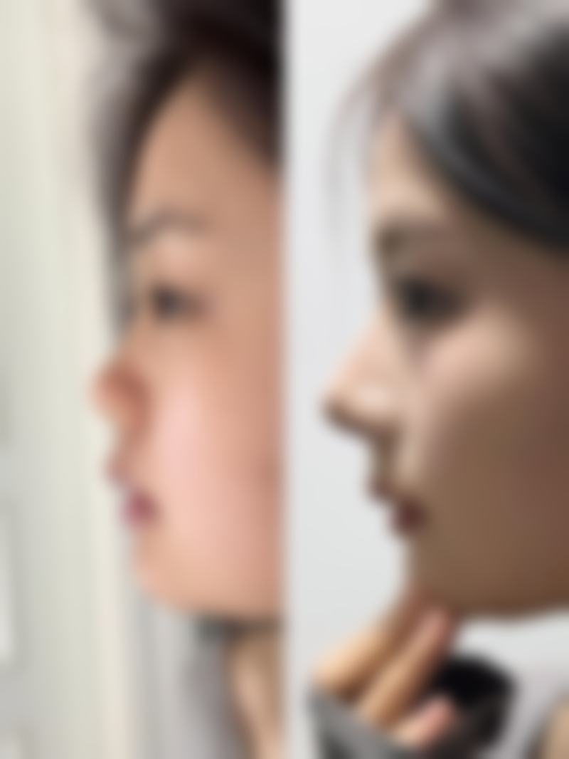 合肥金保立新整形医院口碑评价怎么样？