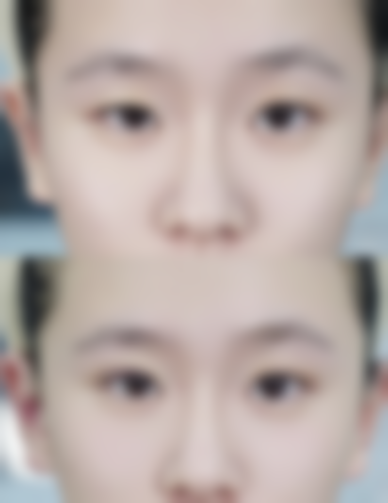 小孩疤痕修复涂什么好？专家推荐有效产品与护理技巧！这些产品和技巧你了解吗？ 