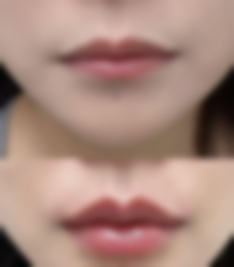 洋葱提取物类药膏有什么特点？