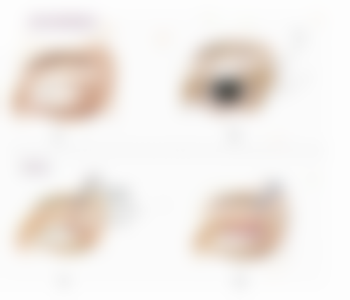 拆线后还有哪些其他护理注意事项？