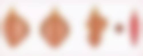 沈阳医 科 大学附属第一医院总院口碑评价怎么样？