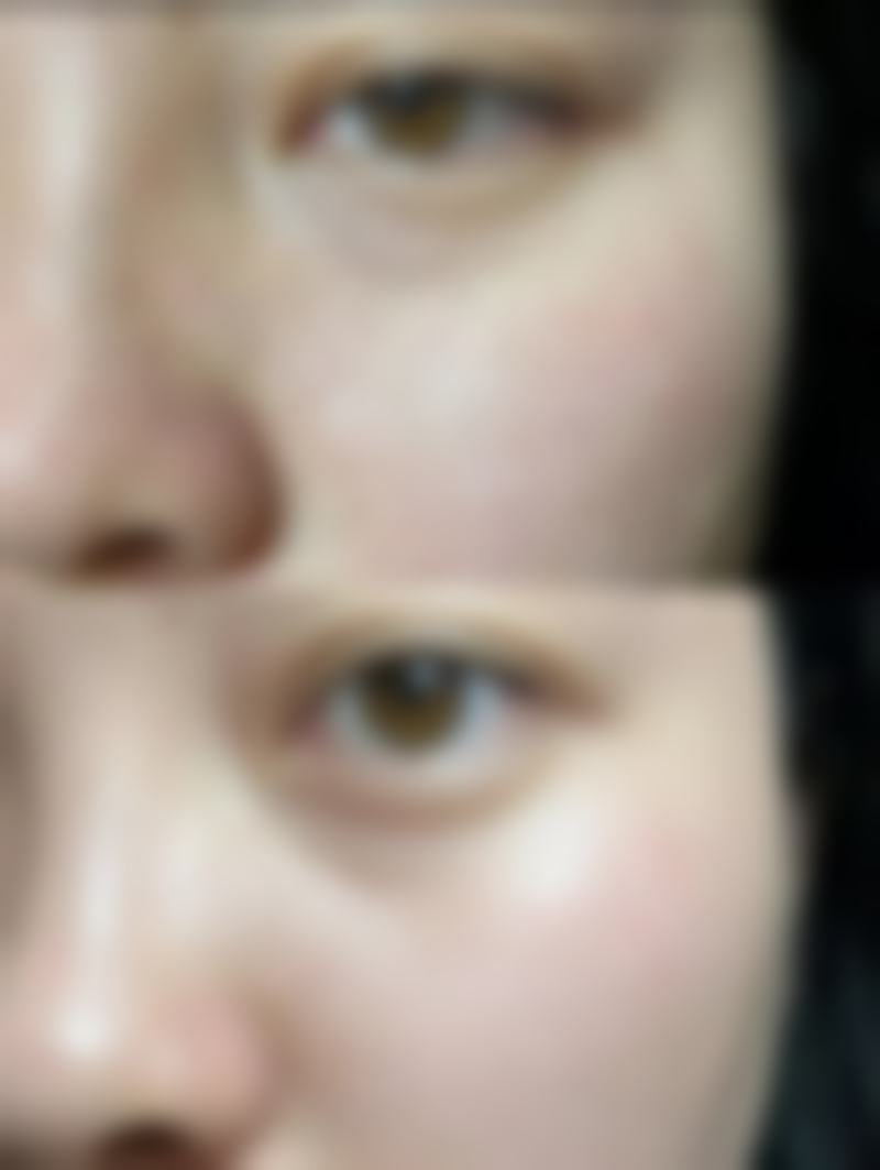 萌大夫“皮美欣”是一款怎样的祛疤产品？