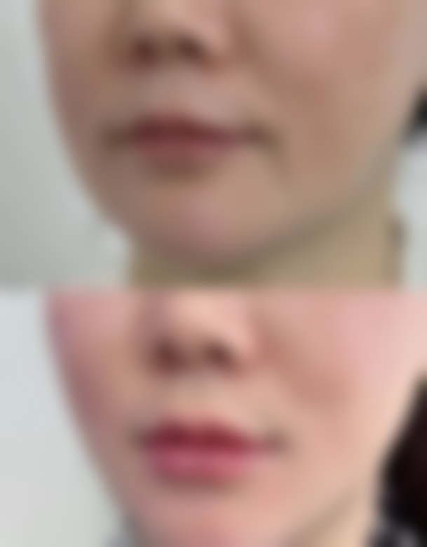 成都伊朵皮肤医疗美容门诊部正规吗？