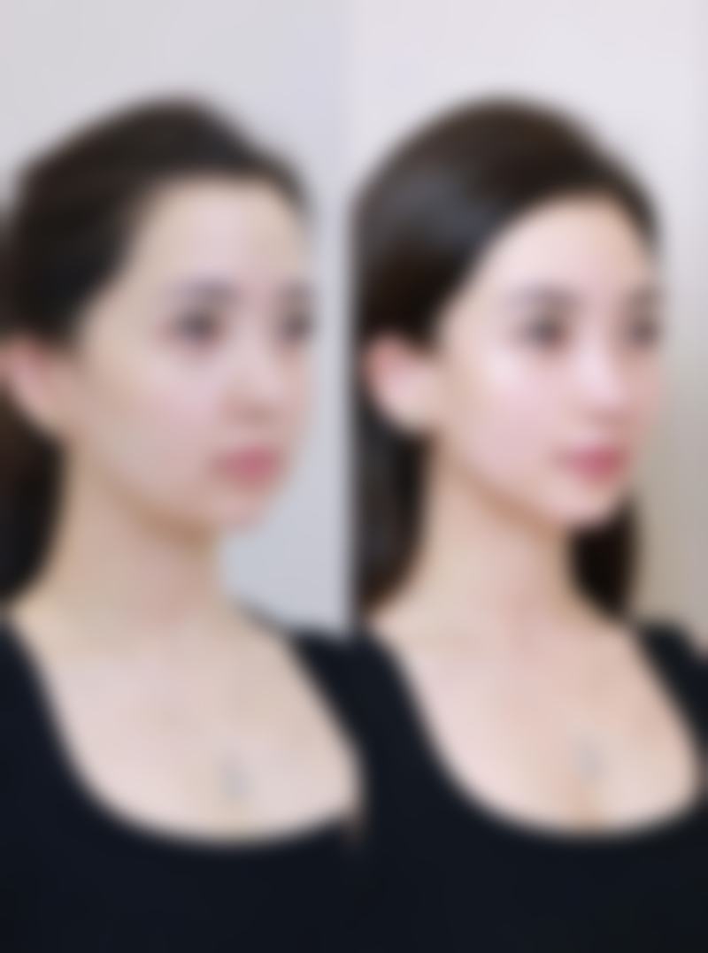 汉中时光整形美容医院口碑评价怎么样？