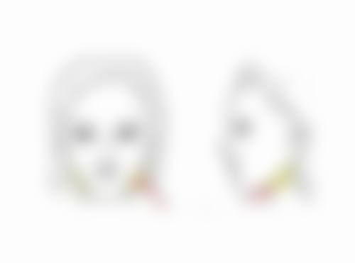 去眼袋内吸的成效真的好吗？