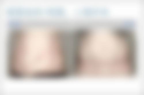 问题二：露卡菲娅小蓝瓶淡纹眼霜有什么成分和功效优势呢？