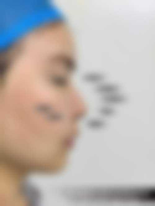 福州艾尚美医疗美容门诊部正规吗？