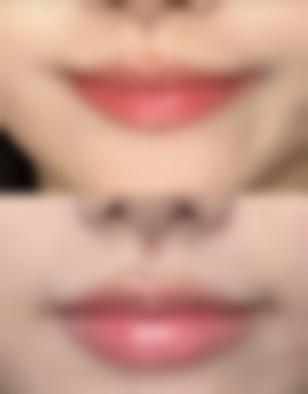 按摩适合哪些疤痕类型？