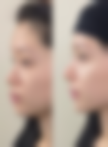 lowell整形外科正规吗？