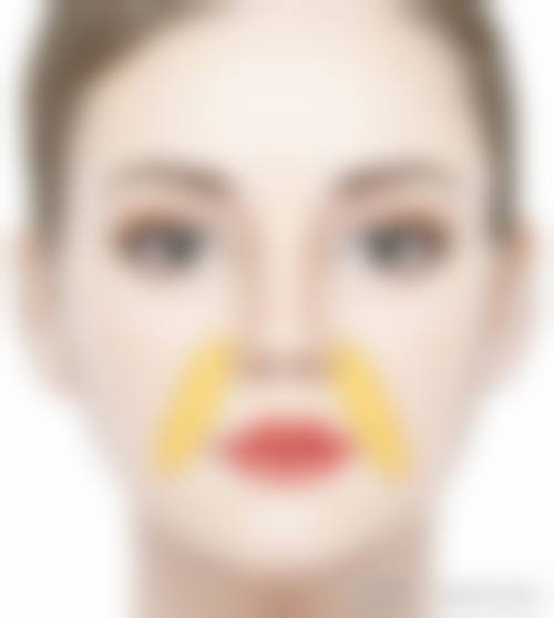 激光治疗对二十多年的疤痕成效如何呢？