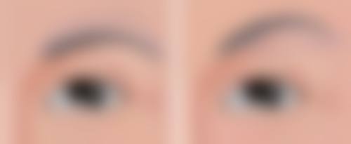 海口段碧辉医疗美容诊所医生介绍