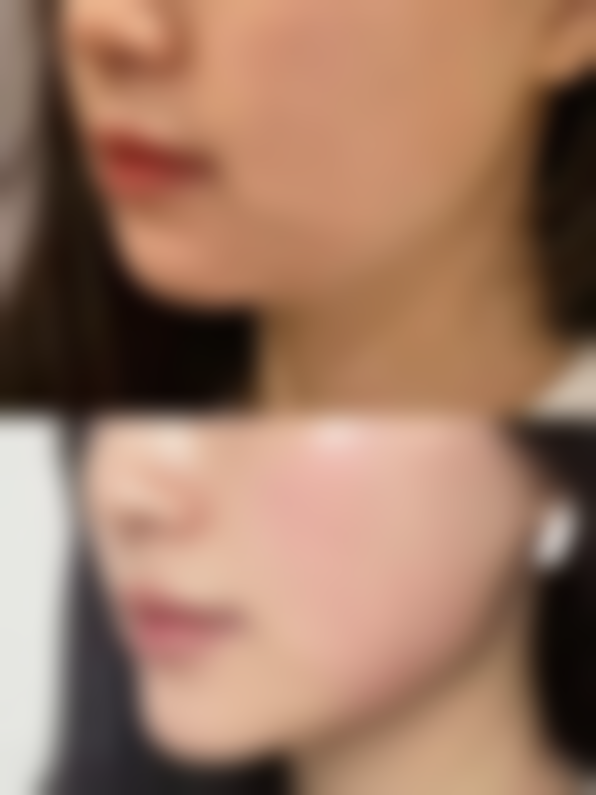 怀化韩美医学美容医院怎么预约