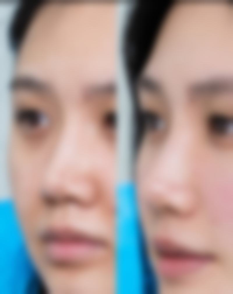 合肥西美医疗美容口碑评价怎么样？