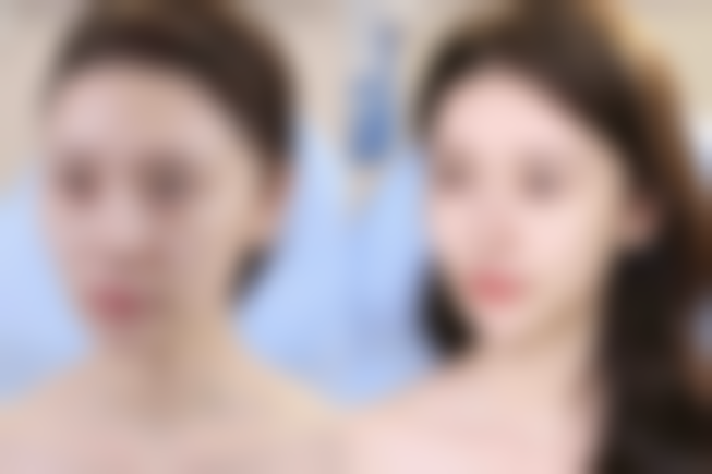 复合型材料（如内盐水外硅胶）的优缺点有哪些？适合什么人群？