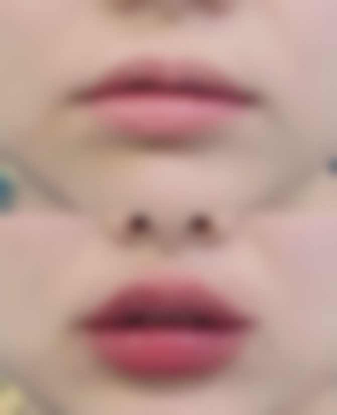 有哪些日常护理的消肿小技巧呢？