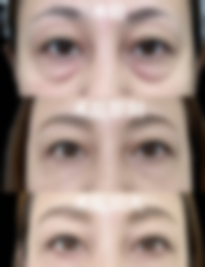 不同的改善方式适用年龄和注意事项是怎样的呢？