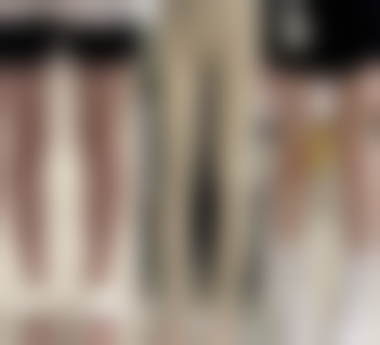 四川成都美容整形医院小阴唇整形手术（内缝单侧）适合哪些人？