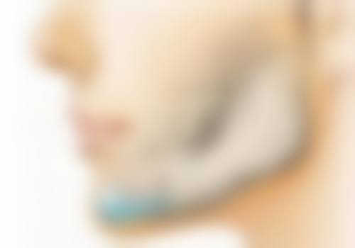 四川成都美容整形医院小阴唇整形手术（内缝单侧）采用了什么技术？