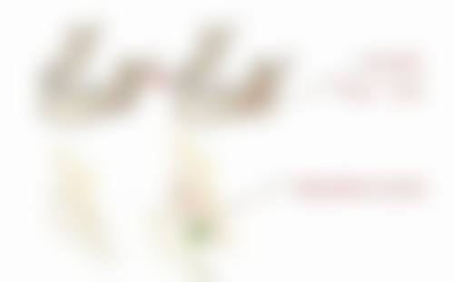 割完眼袋眼睛肿的厉害怎么办？5个有效缓解方法让你快速恢复！恢复后有哪些注意事项呢？ 