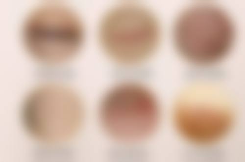 抽脂术后会出现皮肤感觉异常的情况吗？